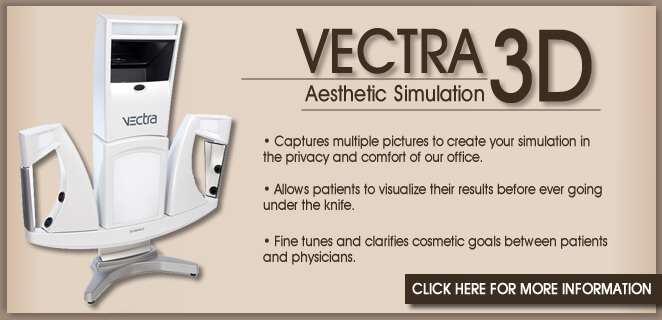 Vectra 3D Breast Lift Imaging